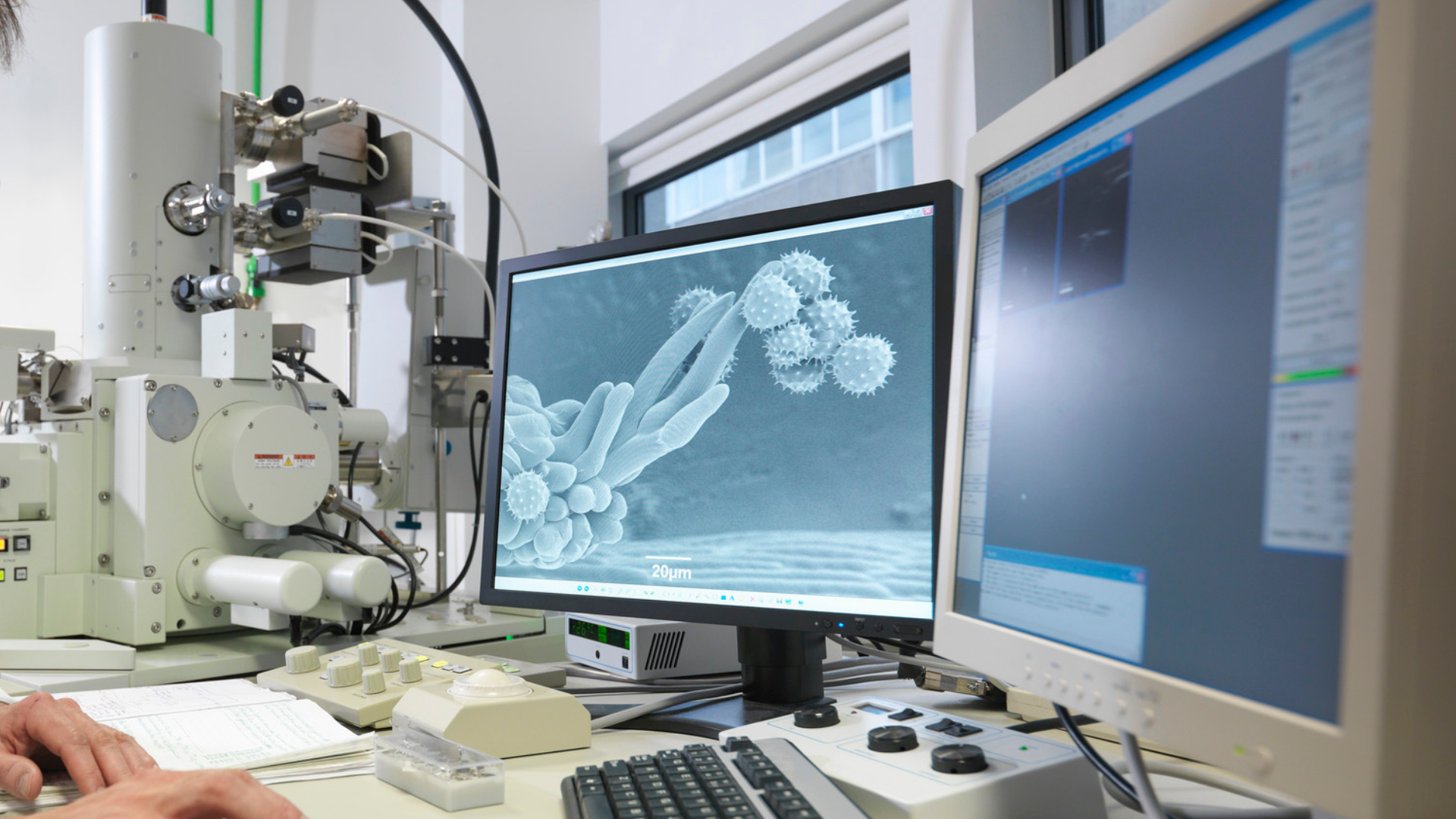 LA GESTIONE MODERNA DELLE PATOLOGIE COMPLESSE TRA IMAGING E LABORATORIO